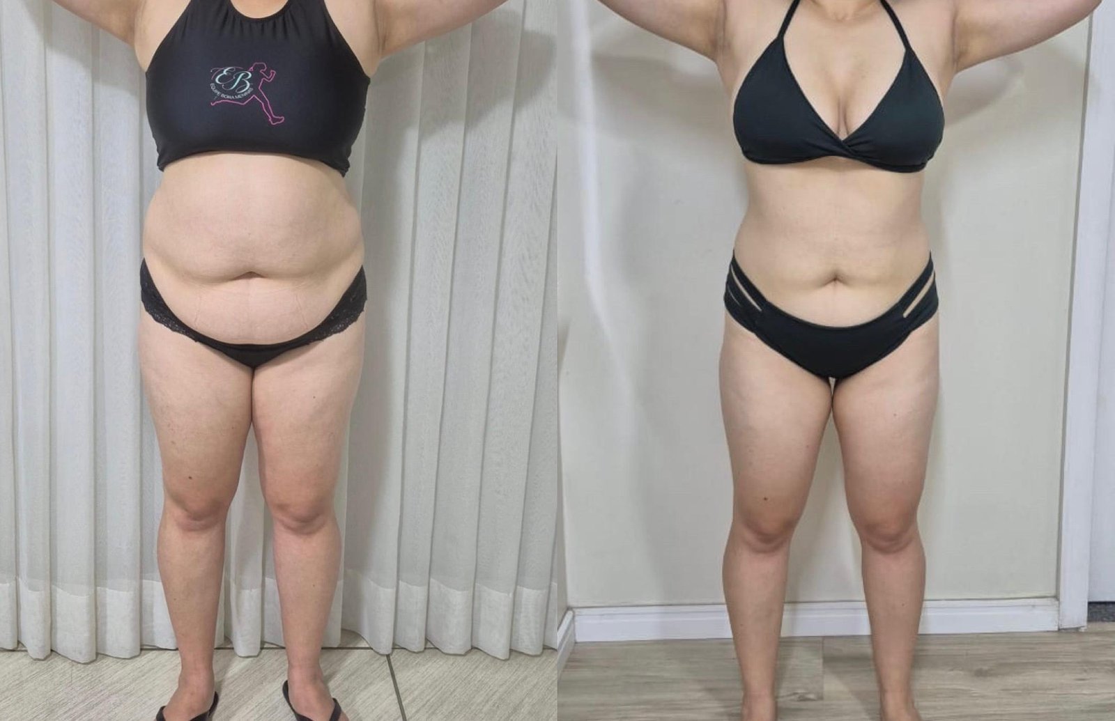 Antes e depois aluna Método GFIT
