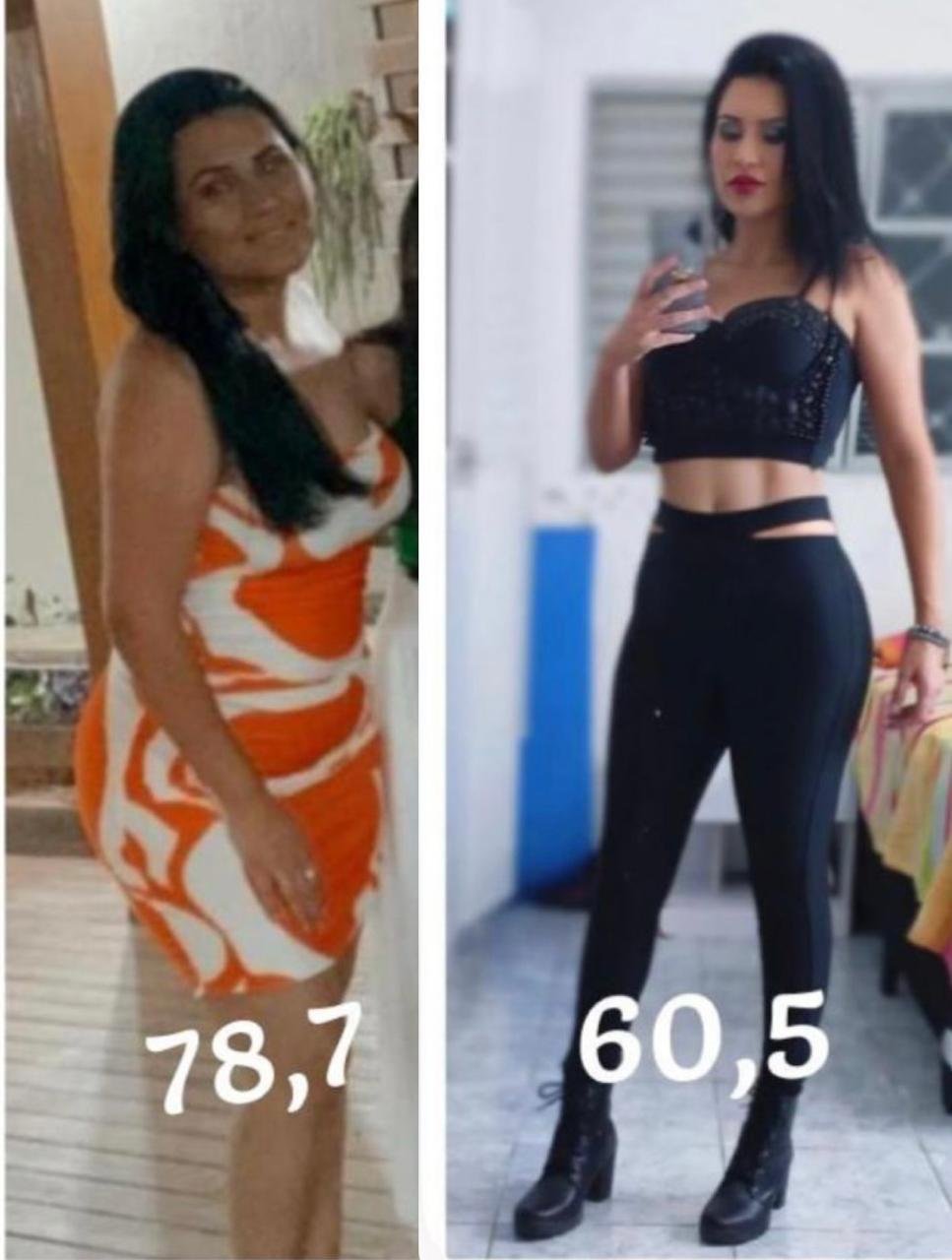 Antes e depois aluna Método GFIT